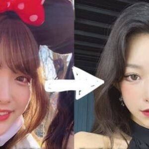 「ゆいぴす」整形前の素顔は可愛かった？整形費用1000万超って本当？